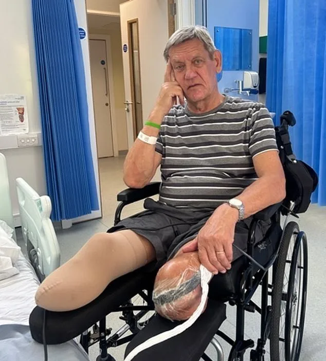 From Active Life to Amputation: Nic Olsen's PAD Journey Exposes UK Healthcare Gaps