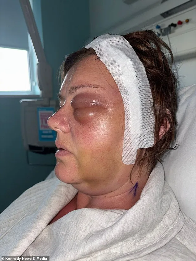 From Mislabeled Mascara to Life-Altering Diagnosis: A Mother's Journey with a Rare Eye Tumor