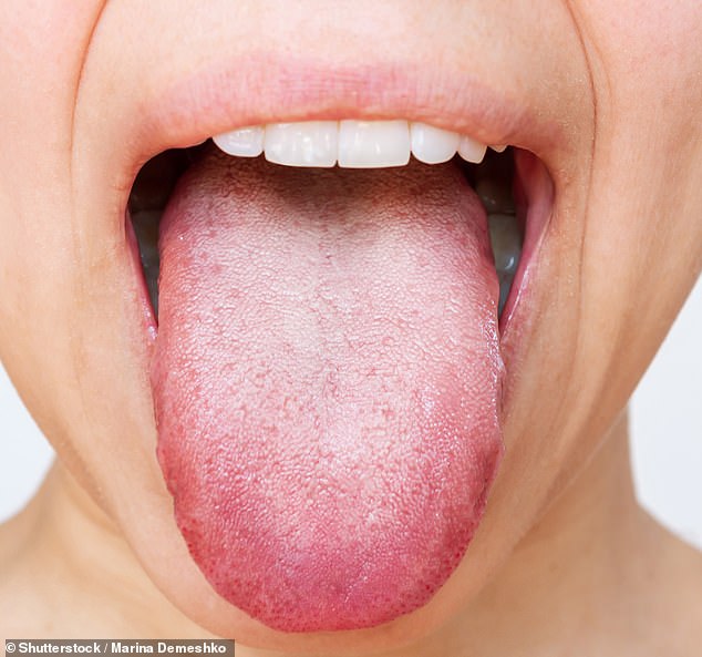 Urgent Advice: Tingling Tongue May Signal Serious Health Issues, Experts Warn