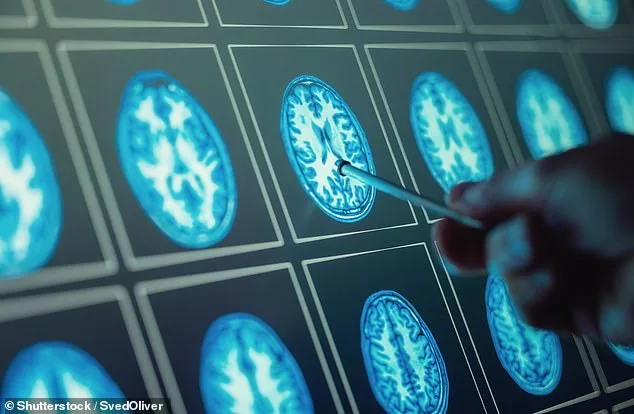 From Expert to Patient: Dr. Jonathan White's Fight Against MS