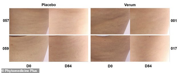 Study Reveals French Maritime Pine Bark Extract Effectively Reduces Cellulite in 90 Days