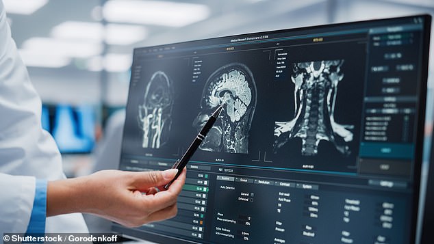 When Headaches Signal Danger: Recognizing Life-Threatening Conditions