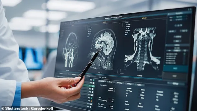 When Headaches Signal Danger: Recognizing Life-Threatening Conditions