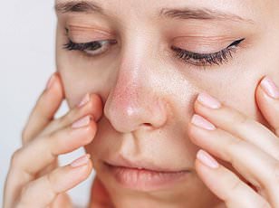 Mounjaro Injections: Rapid Weight Loss Comes with Nausea and Hair Loss, Experts Warn