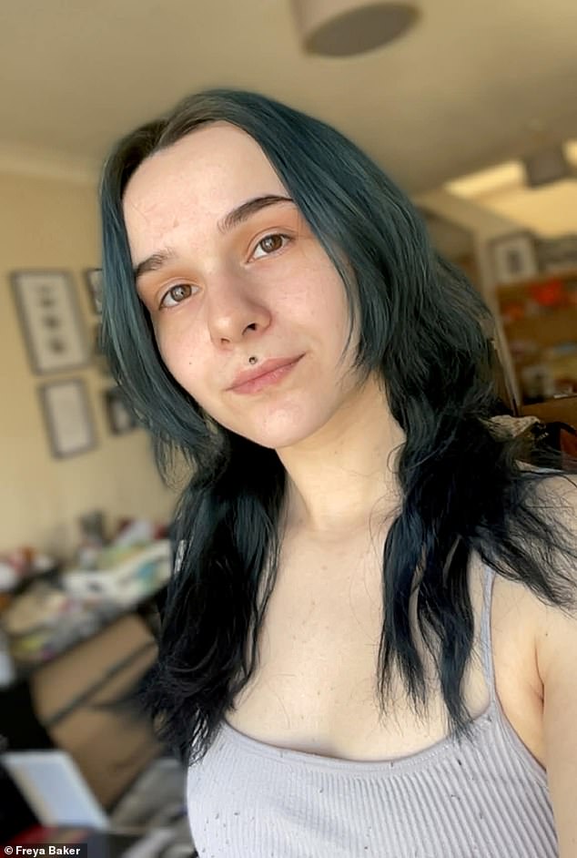 The Unseen Battle of Freya Baker: Living with Hyperhidrosis and the Weight of Shame