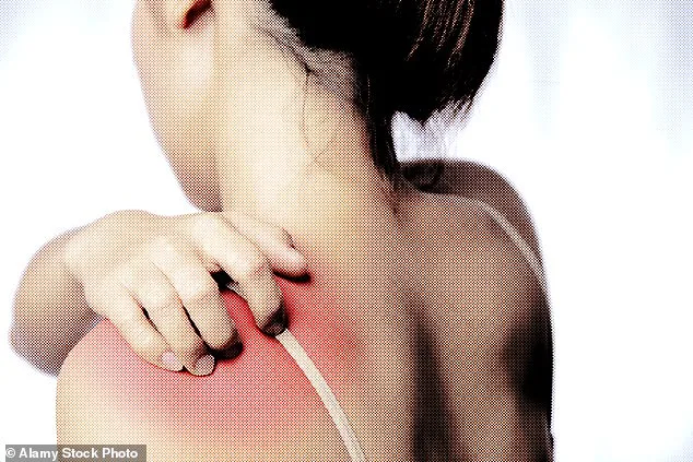 Surge in Psoriasis Cases in the UK: Social Stigma and the Need for Greater Awareness