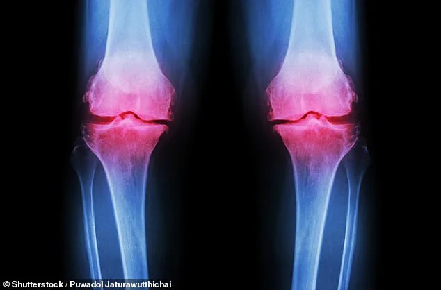 Columbia University Researchers Engineer Lab-Grown Human Knee Offering Hope for Osteoarthritis Patients