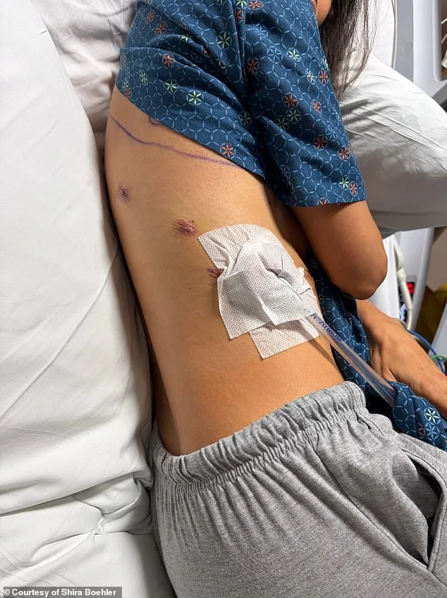 Lung Cancer's Alarming Shift: Rising Cases Among Young, Healthy Non-Smokers