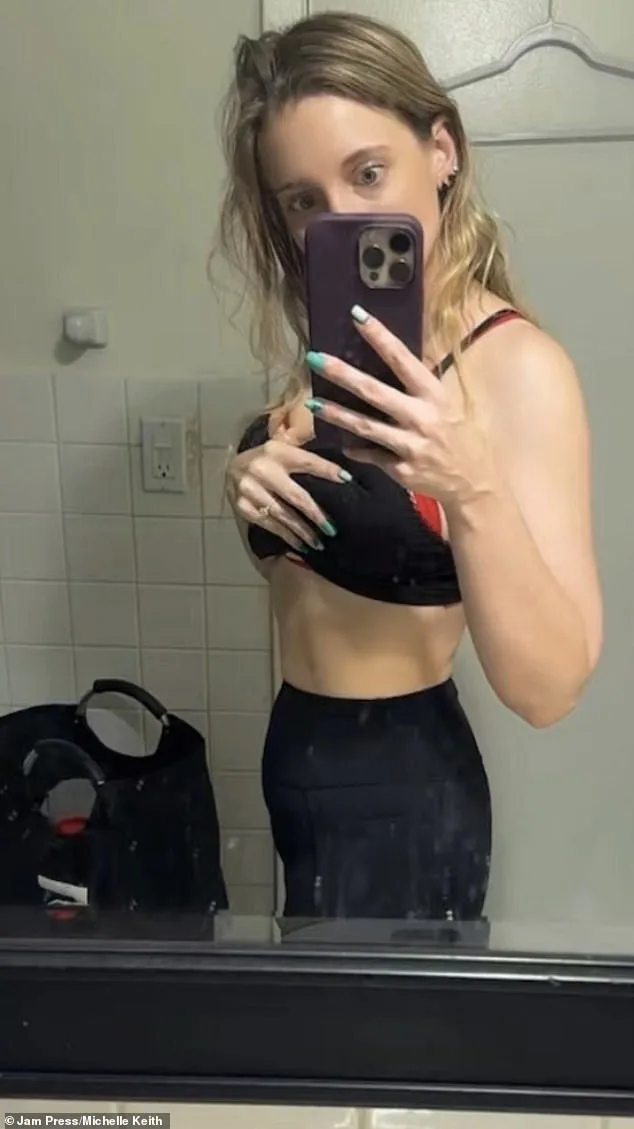 From Invisible to Empowered: How a Rare Diagnosis Changed Michelle Keith's Life