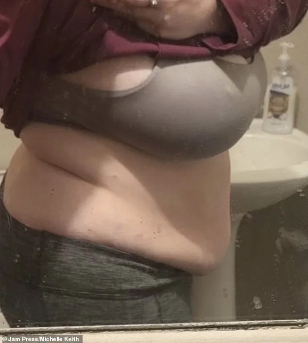 From Invisible to Empowered: How a Rare Diagnosis Changed Michelle Keith's Life