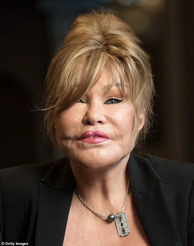 Intimate Photos of Jocelyn Wildenstein and Her Ex-Husband Offer Glimpse into Their Personal Life