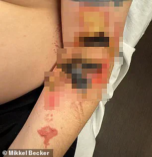 Father-of-Six Diagnosed with Ultra-Rare Skin Disease Given Six Months to Live