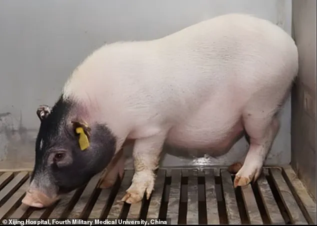 Historic First: Human Receives Transplanted Pig Liver, Opening New Avenues for Organ Transplants