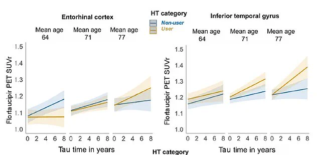 Hormone Replacement Therapy in Sixties Linked to Higher Risk of Alzheimer's Protein Buildup