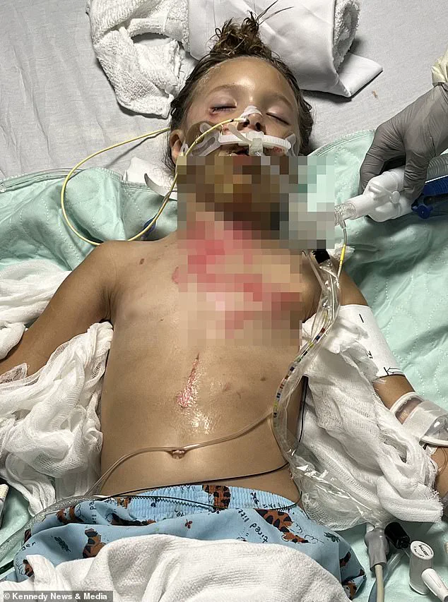 Seven-Year-Old Girl Seriously Injured After Microwaving Squishy Toy NeeDoh
