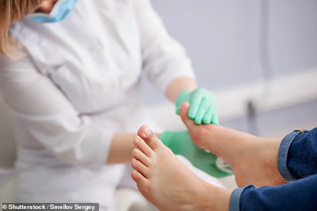 The Little-Known Toe Condition Ringing Alarm Bells in the Medical Community