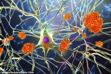Exclusive Access: UC Irvine Scientists Develop Lab-Grown Immune Cells with Potential to Reverse Alzheimer's