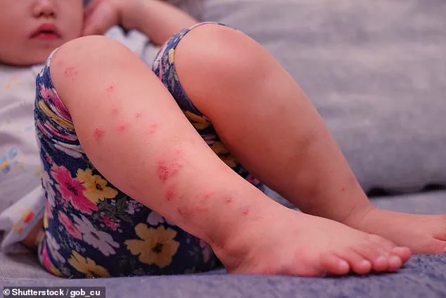 Fifty People Potentially Exposed to Measles in Michigan Outbreak