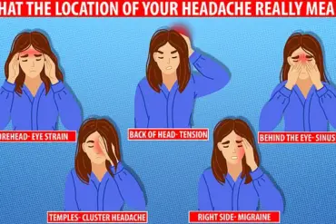 Once-Daily Pill Atogepant Approved for NHS to Cut Migraine Attacks by Half