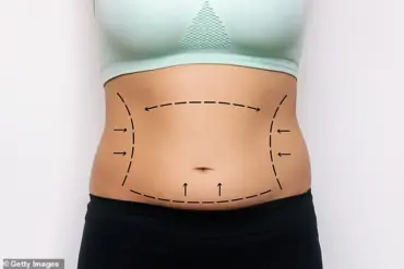 Ozempic-Driven Weight Loss Fuels Surge in Plastic Surgery Procedures