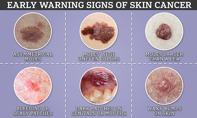 Top Cancer Doctor Urges Public Awareness of Early Warning Signs for Cancer