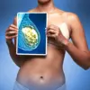 Debate Over Male Health Workers Performing Breast Screenings Intensifies Amid NHS Shortage and Concerns Over Patient Trust and Privacy