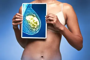 Debate Over Male Health Workers Performing Breast Screenings Intensifies Amid NHS Shortage and Concerns Over Patient Trust and Privacy