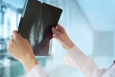 Exclusive Access to Groundbreaking Breast Cancer Treatment: New Pill Shows Twice the Survival Benefits, But Availability is Limited