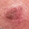 Breaking: New Insights into Skin Health Reveal Urgent Need for Advanced Diagnostic Approaches
