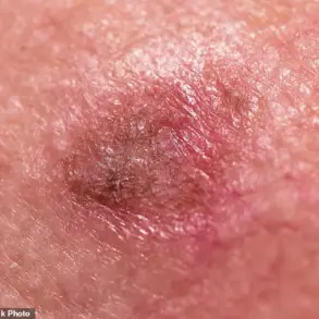 Breaking: New Insights into Skin Health Reveal Urgent Need for Advanced Diagnostic Approaches