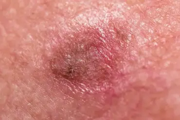 Breaking: New Insights into Skin Health Reveal Urgent Need for Advanced Diagnostic Approaches
