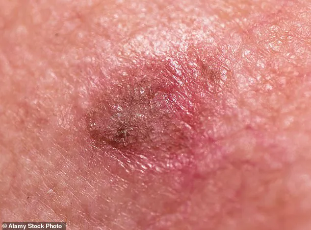 Breaking: New Insights into Skin Health Reveal Urgent Need for Advanced Diagnostic Approaches