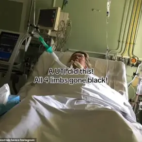 From Minor Infection to Amputation: The Hidden Peril of Sepsis