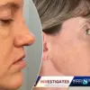 Japanese YouTuber's Claim of World's Longest Chin Captures Global Attention and Medical Curiosity