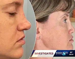 Japanese YouTuber's Claim of World's Longest Chin Captures Global Attention and Medical Curiosity