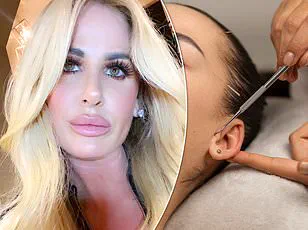 Maddison Steiner's Botched Breast Augmentation Sparks Debate Over Post-Operative Care Compliance