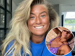 Megan Blain's Sunbed Addiction: 'I Didn't Know the Damage Until It Was Too Late' – Experts Warn of Public Health Risks