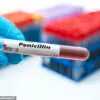 Millions Living Under Shadow of Misdiagnosed Penicillin Allergy, Study Reveals Major Medical Record Inaccuracy Crisis