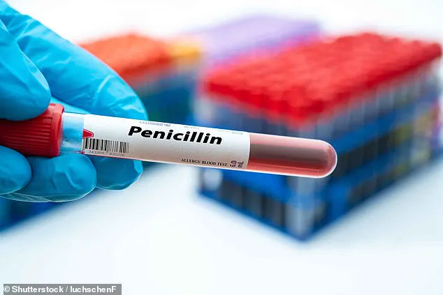 Millions Living Under Shadow of Misdiagnosed Penicillin Allergy, Study Reveals Major Medical Record Inaccuracy Crisis