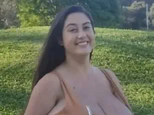 Public Health Debate Over NHS Breast Reduction Surgery Access Grows as Mother's Macromastia Struggle Highlights Patient Challenges
