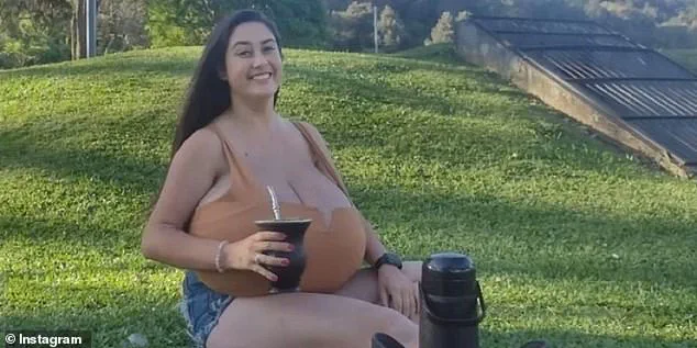 Thaynara Marcondes' Battle with Gigantomastia: A Rare Condition and a Triumph of Resilience