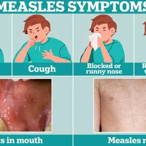 Urgent Concerns Over Declining MMR Vaccination Rates in UK Cities: Experts Warn of Measles Resurgence Amid Tragic Liverpool Incident