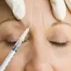 Urgent Warning: UKHSA Alerts Public to Botulism Outbreak Linked to Unlicensed Botox-Like Product, as 40 Cases Reported in East of England and East Midlands
