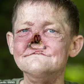 William Brogan's Cancer Battle Sparks Conversation on Early Diagnosis and Facial Reconstruction Challenges