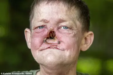 William Brogan's Cancer Battle Sparks Conversation on Early Diagnosis and Facial Reconstruction Challenges