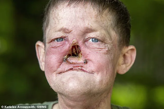 William Brogan's Cancer Battle Sparks Conversation on Early Diagnosis and Facial Reconstruction Challenges