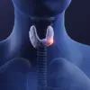 A Decade of Dismissal: How Healthcare Gaps Led to Thyroid Cancer Diagnosis