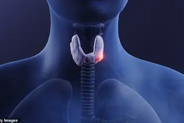 A Decade of Dismissal: How Healthcare Gaps Led to Thyroid Cancer Diagnosis