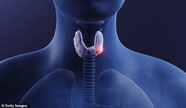 A Decade of Dismissal: How Healthcare Gaps Led to Thyroid Cancer Diagnosis