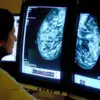 Beta Blockers May Slow Spread of Aggressive Triple-Negative Breast Cancer, Study Suggests